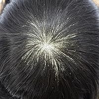 Vista 6 de Toupee - Sistema de reemplazo de piezas de cabello humano real, unidades de cabello humano real, parche de cabello tipo tupé, pieza de cabello