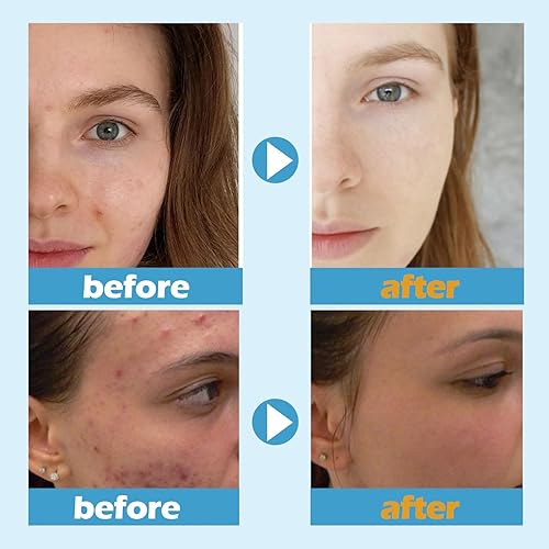 Miniatura 7 de Retinol Snake Venom - Máscara dorada rejuvenecedora, mascarilla dorada antienvejecimiento, máscara facial dorada con retinol y péptido de veneno de