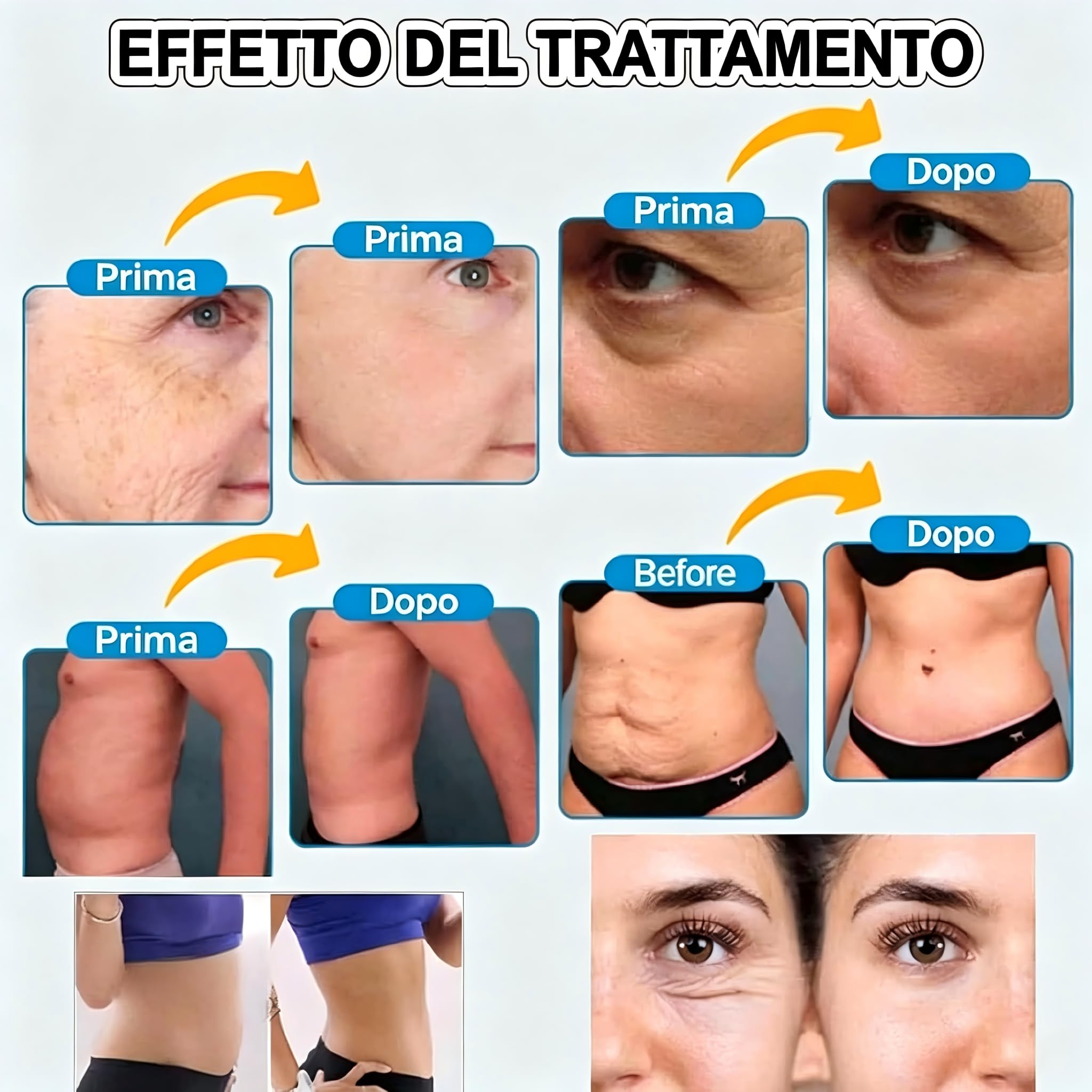 Macchina 7D HIFU Non Invasiva Lifting Viso Corpo Sonde 1.5-13mm Riduzione Rughe Certificata CE