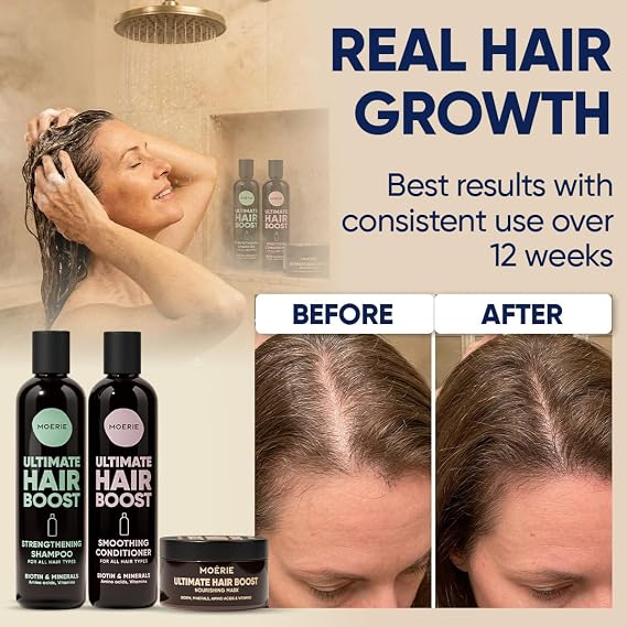 Moerie Ultimate Mineral Shampoo and Conditioner Set - Vegan Friendly, Paraben Free, Hair Growth Products for Longer, Thicker, Fuller Hair - Includes Hair Mask