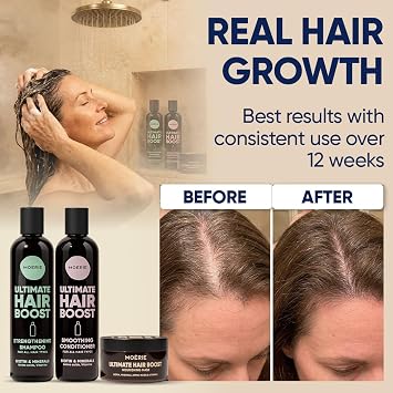 Moerie Ultimate Mineral Shampoo and Conditioner Set - Vegan Friendly, Paraben Free, Hair Growth Products for Longer, Thicker, Fuller Hair - Includes Hair Mask