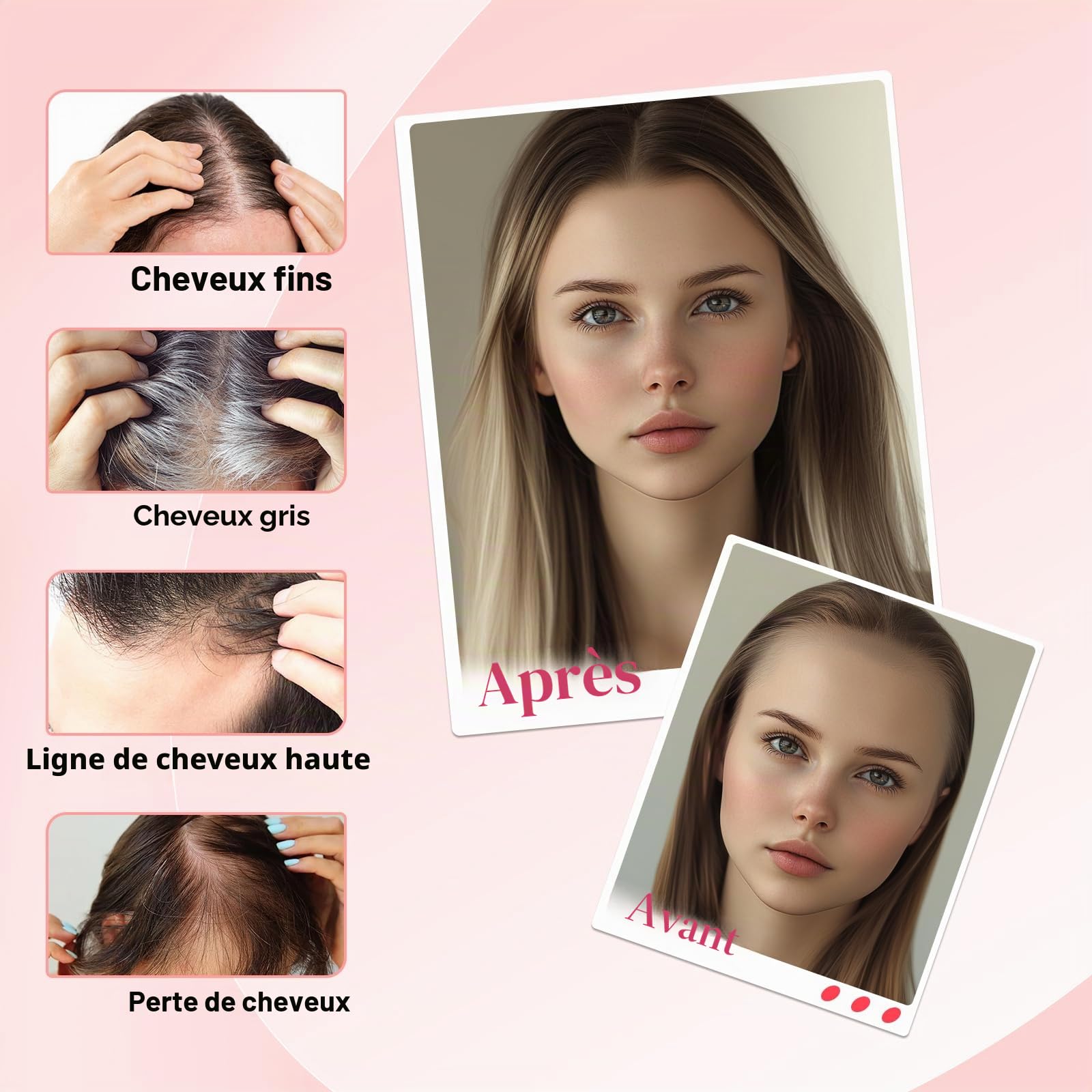 Elailite Volumateur Capillaire Femme Naturel a Clip Cheveux Naturel Toupet Humain (Base 10cm*12cm) 15cm 27g #4+27 MARRON CHOCOLAT MECHE BLOND FONCE
