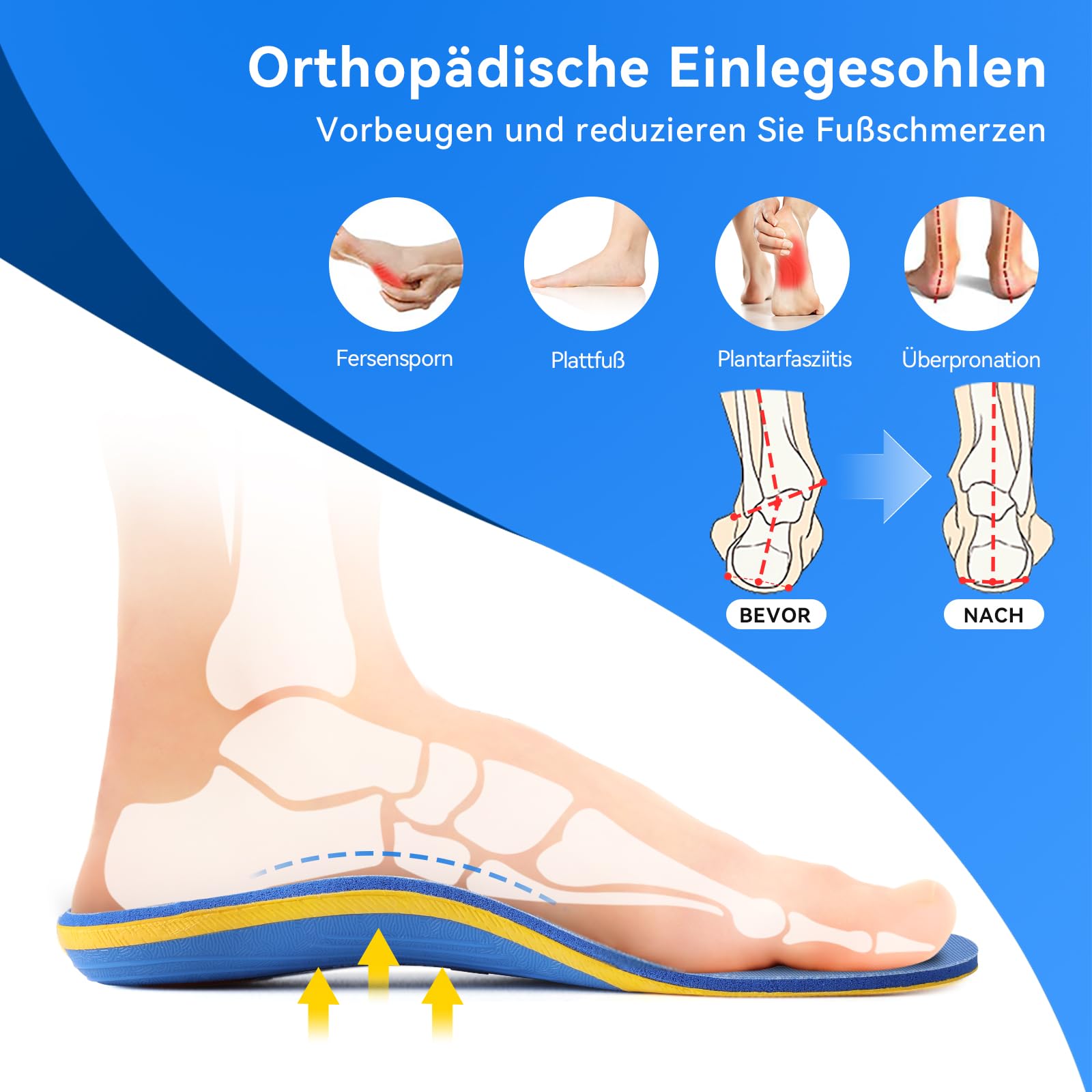 3ANGNI Semelles orthopédiques pour pieds plats,fasciite plantaire,épine calcanéenne,douleurs au talon pour femmes et hommes