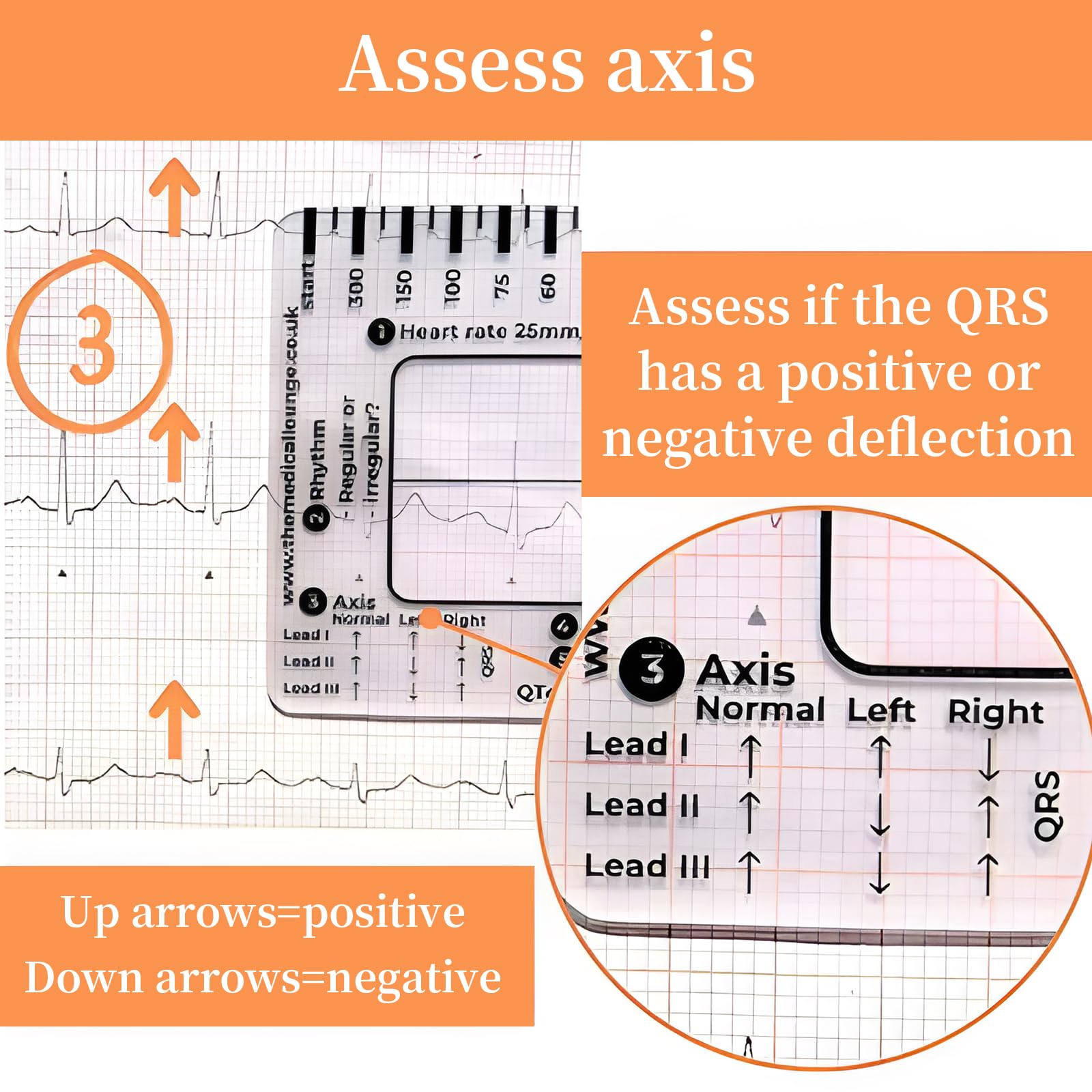 Règle ECG 7 étapes Portable - Carte Plastique Transparente 9x6,5cm - Neuf - Pour Infirmières