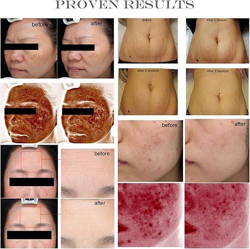 Miniatura 5 de CUTEGO Polvo de factor de crecimiento de fibroblastos ácidos, polvo liofilizado aFGF grado cosmético para piel antienvejecimiento, 1 miligramos,