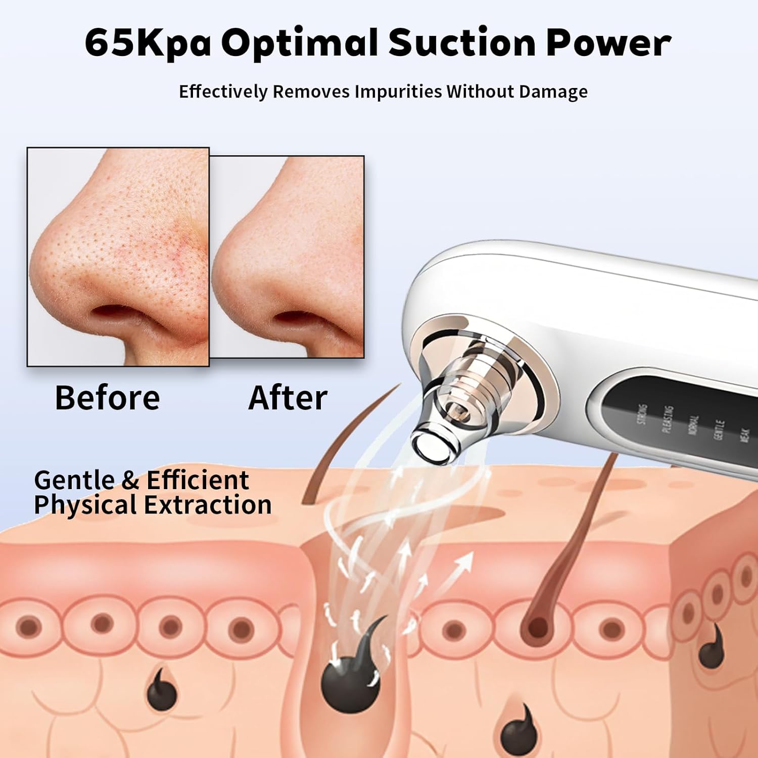 Pore Vacuum Blackhead Extractor for Face, Pearl White Blackhead Remover Vacuum with 5 Modes, 4 Heads, Pore Cleaner Tool, USB-C Rechargeable, Portable Storage - Image 2