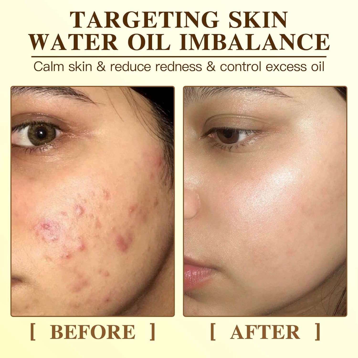 Radiance Turmeric Collagen Face Mask, 5 Pack - Overnight Calming Ance Mask with Kojic Acid for Roughed Skin & Dullness, Oil Control & Pore Refining Facial Sheet Mask - Image 5