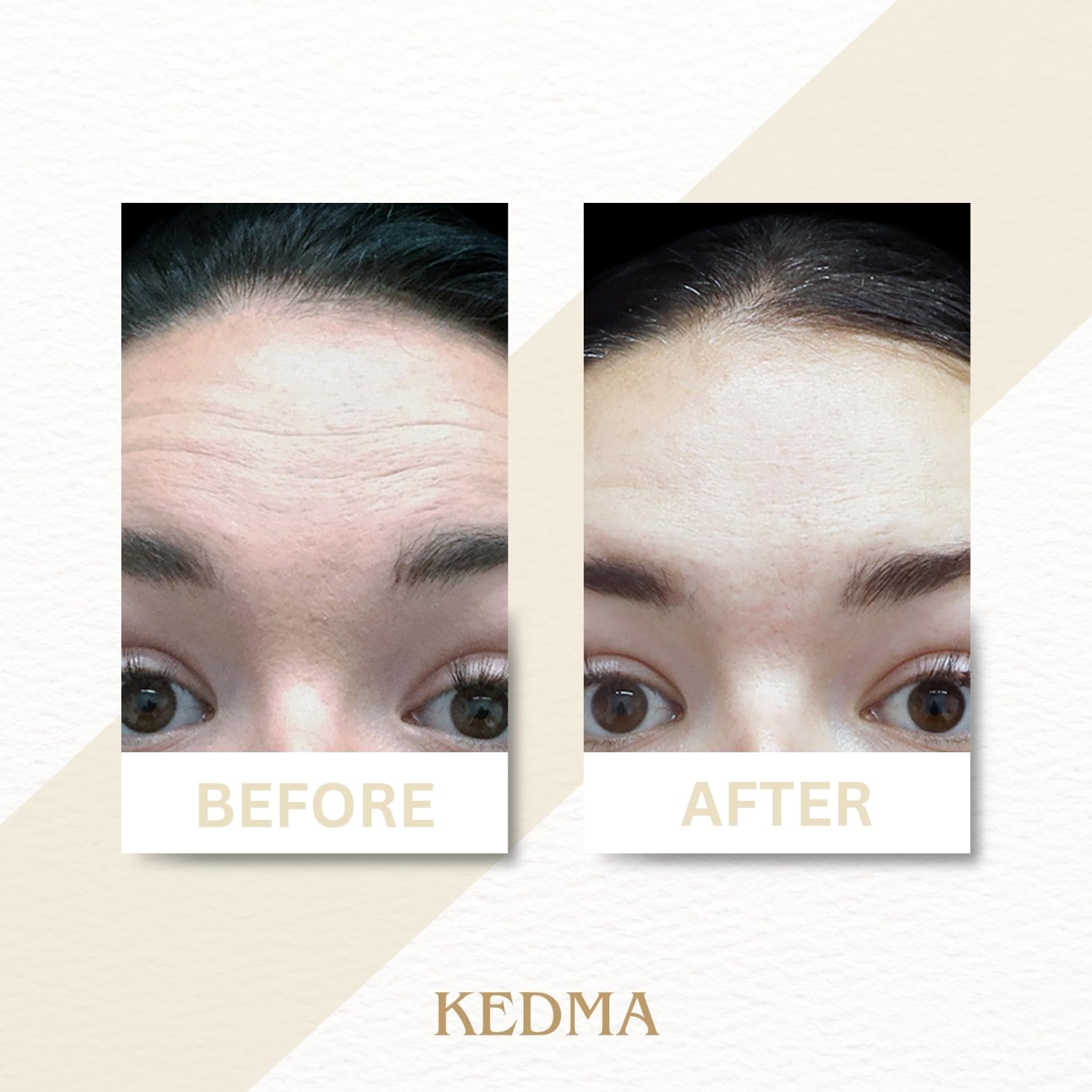 KEDMA - Crème Visage au Collagène et Minéraux de la Mer Morte - 50g | La crème visage au collagène et aux minéraux de la Mer Morte hydrate et aide à préserver l’élasticité de la peau.
