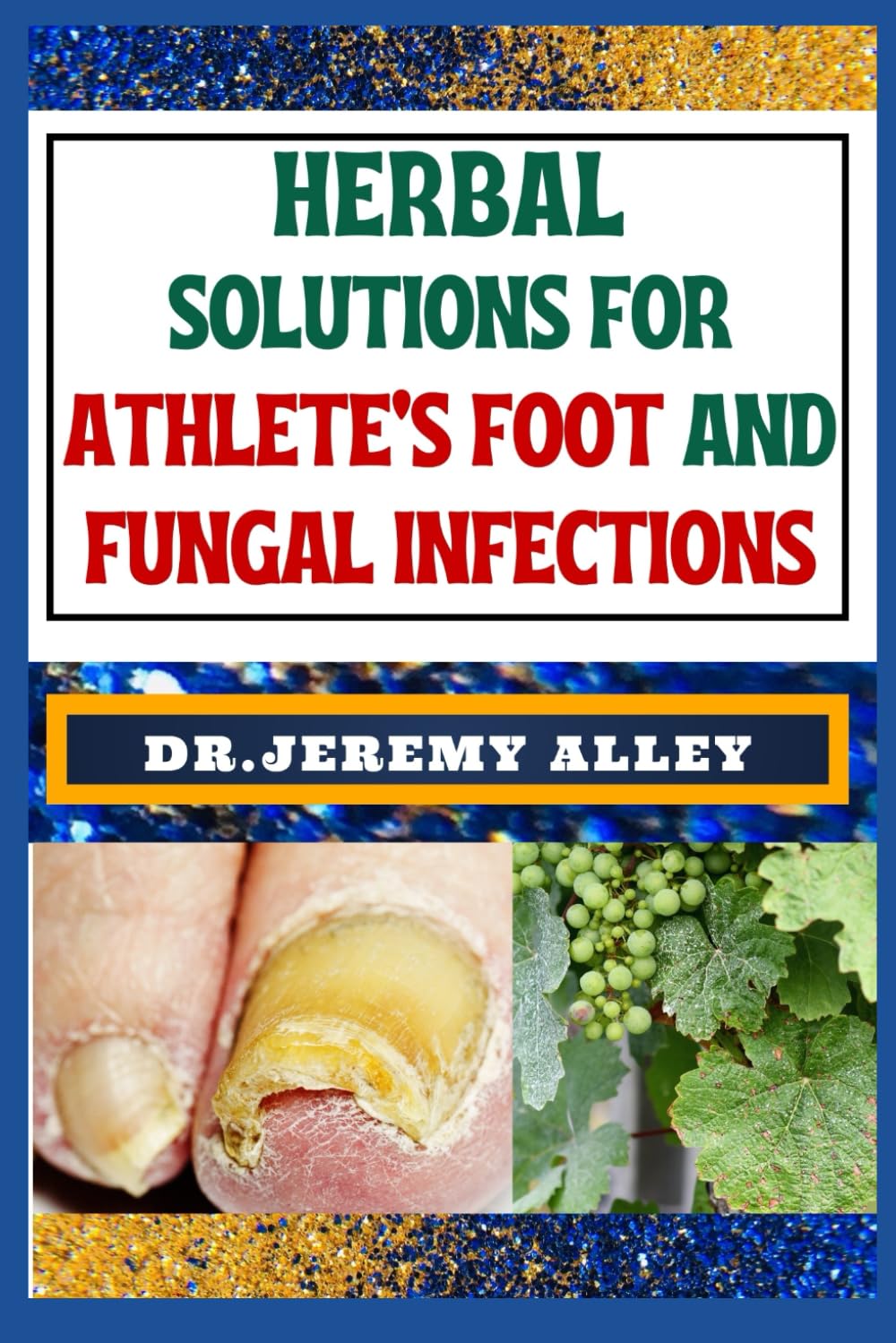 HERBAL SOLUTIONS FOR ATHLETE’S FOOT AND FUNGAL INFECTIONS: Step Into The Healing Garden, Unveiling Herbal Remedies For Naturally Defeat Disease Intruders