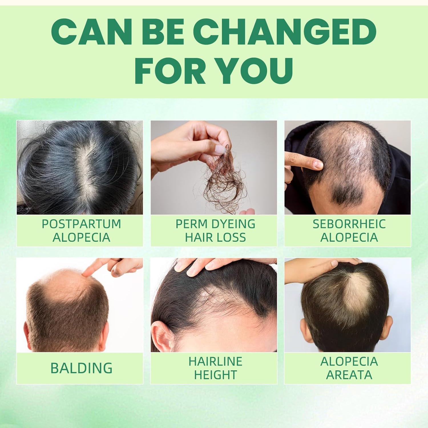 Hair Regrowth System, Advanced Hair Growth Oil with Ginseng, Ginger Root and Peppermint Oil, Regrowth Serum for Strengthens Roots, Thicker Healthier Hair (1box) - Image 7