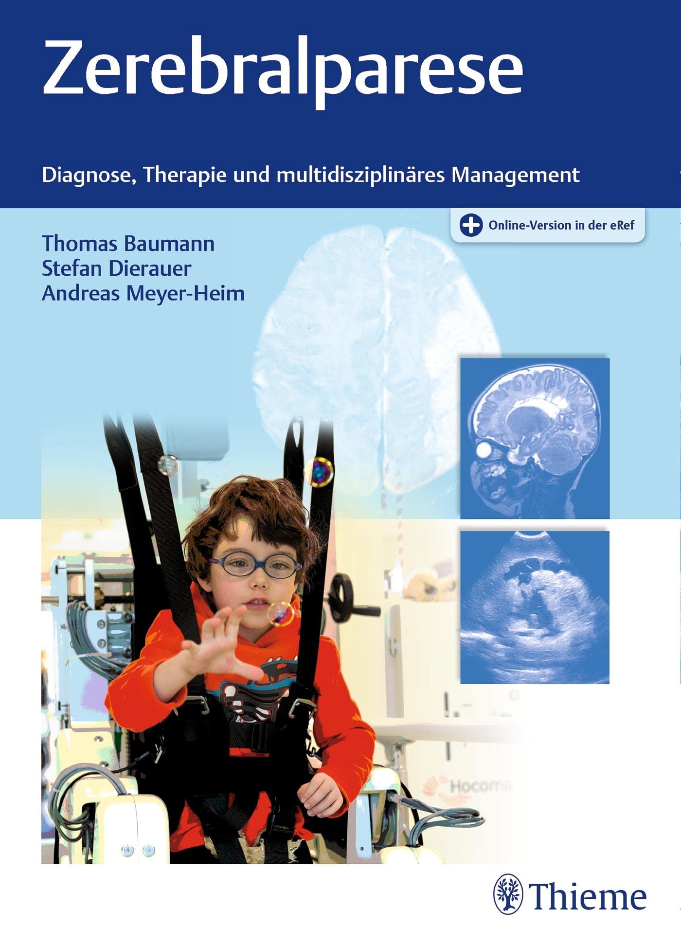 Zerebralparese: Diagnose, Therapie und multidisziplinäres Management