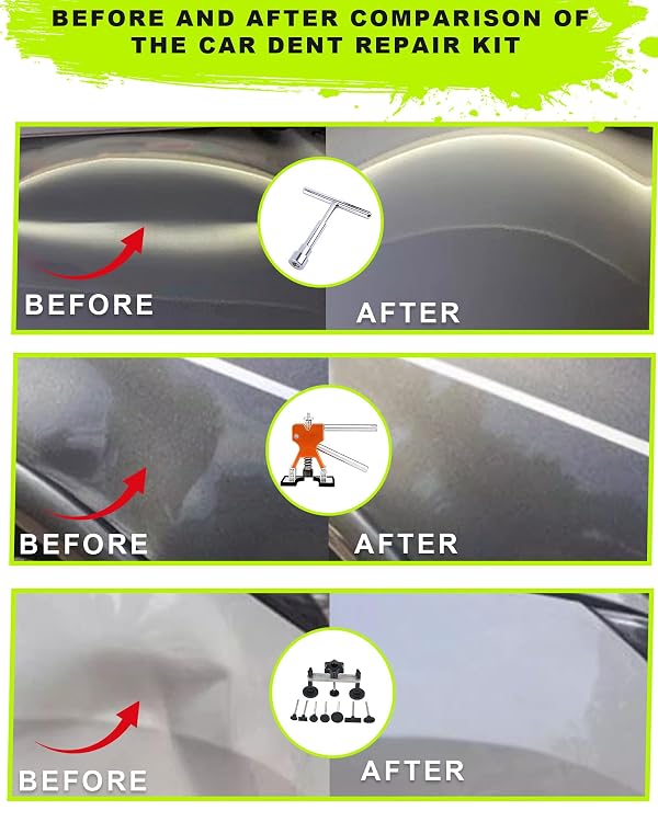 132pcs Dent Puller Kit,Car Dent Repair Kit,Paintless Dent Removal Kit with Suction Cup & Bridge Puller & Golden Lifter,Dent Remover Tool for Car,Auto Body Repair Dent Removal Tools for Hail Door Dings by beautiebeam - Used condition - Image 6