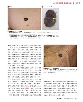【裁断済み】 誤診されている皮膚疾患 レジデント2020年2月 Vol.13No.2 特集:日常診療でよくみる皮膚