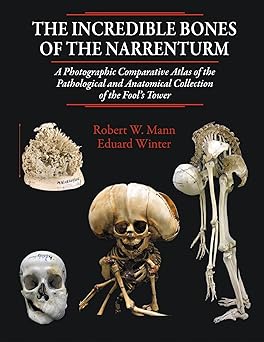 The Incredible Bones of the Narrenturm Photographic Comparative Atlas of the Pathological and Anatomical Collection of the Fools Tower
