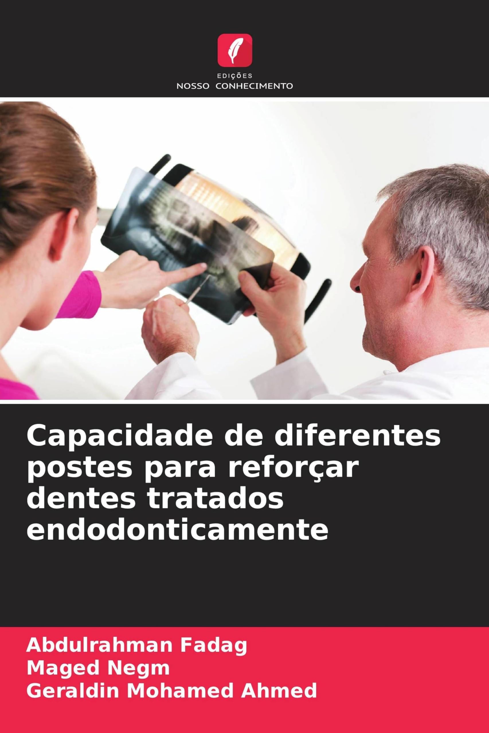 Capacidade de diferentes postes para reforçar dentes tratados endodonticamente