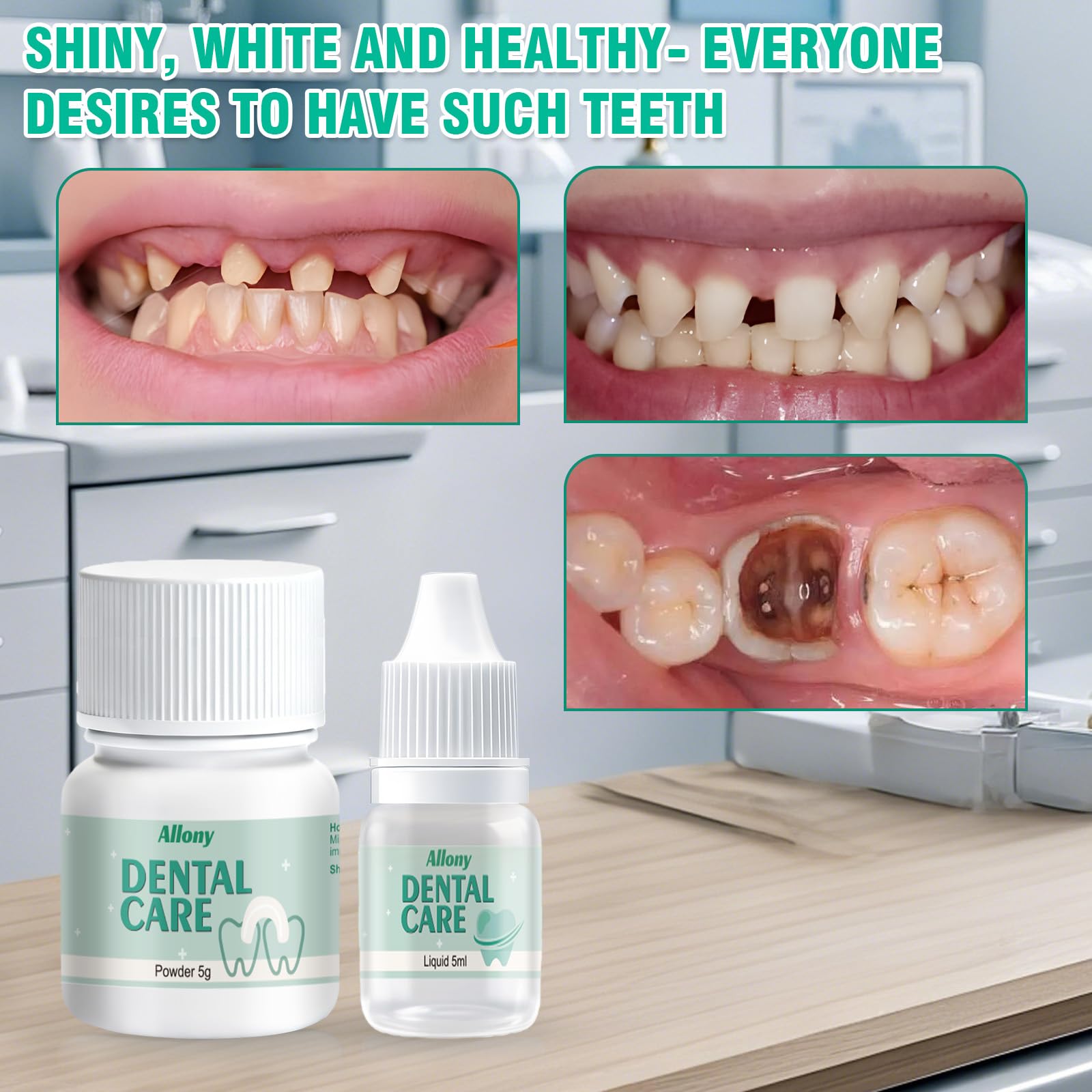Cemento Dental Composite Kit de Fijación para Corona y Puente