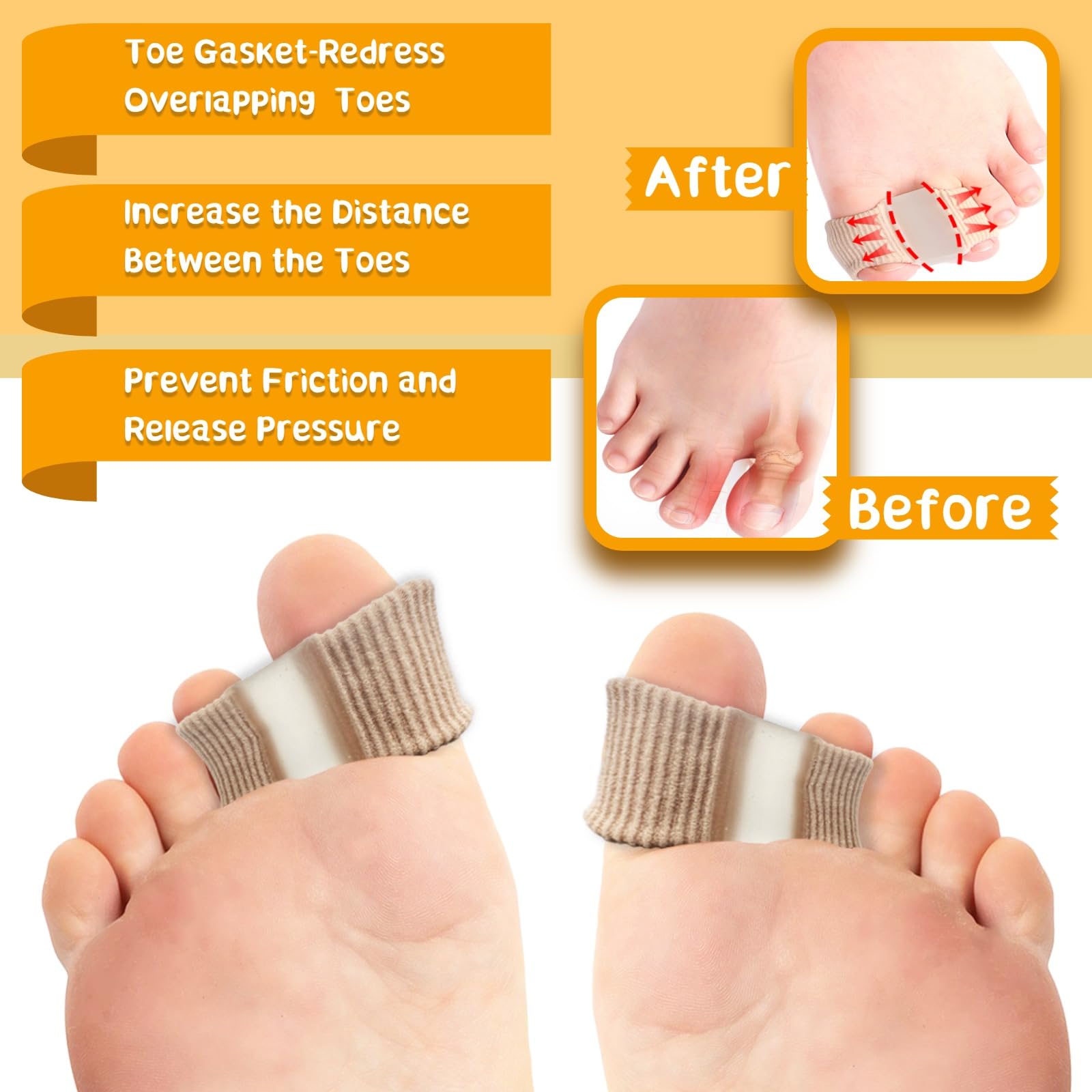 Chuanhylis 6 Pcs Toe Separator,Bunion Corrector With 2 Loops - Image 3