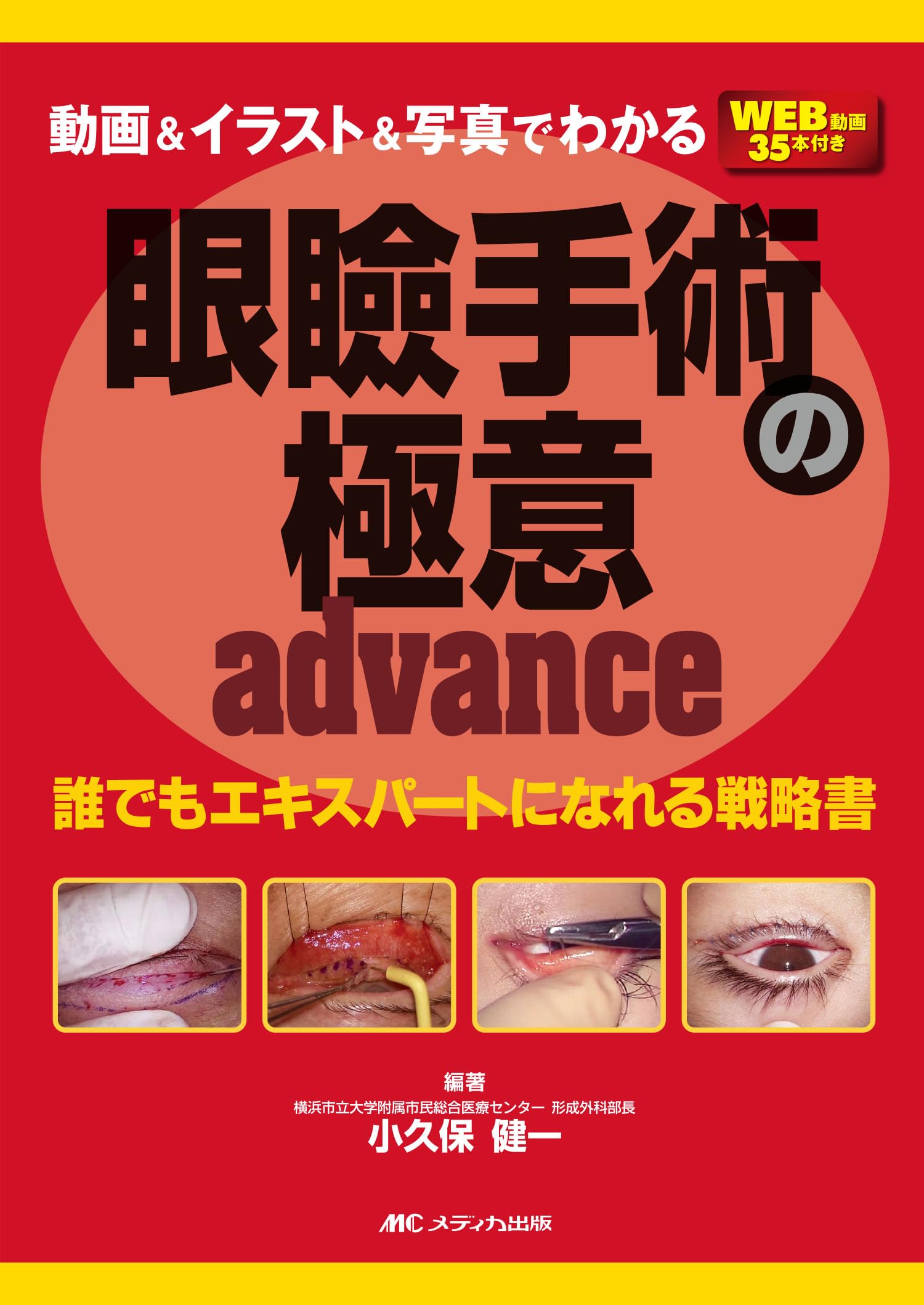 動画＆イラスト＆写真でわかる眼瞼手術の極意 advance：誰でも 