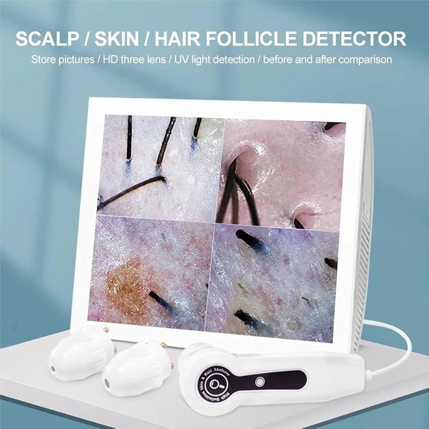 Analizzatore per Capelli e diagnosi della Pelle, 15 Pollici 50X 200X Cuoio capelluto follicolo pilifero Pelle, rilevatore di Cuoio capelluto Capelli Pelle, Tester follicolo pilifero