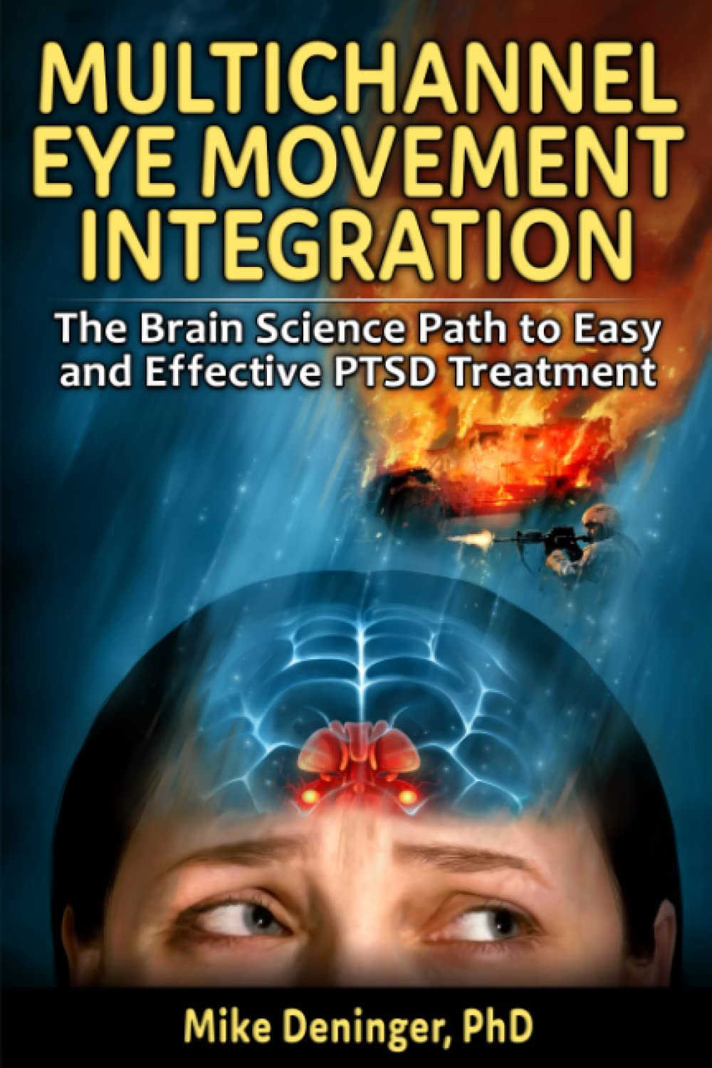 Multichannel Eye Movement Integration: The Brain Science Path to Easy and Effective PTSD Treatment
