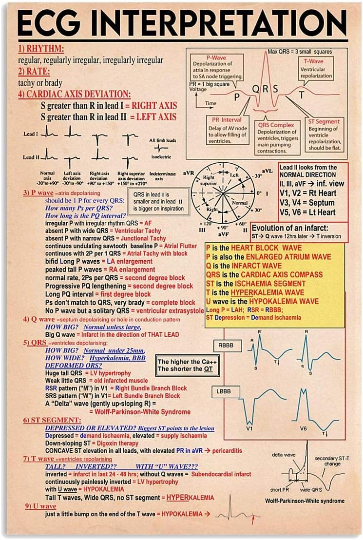 rayprint ECG Interpretation Metal Tin Sign Doctor's Office Decor ECG Knowledge Tin Poster Club Home Wall Decoration Plaquees 8x12inch