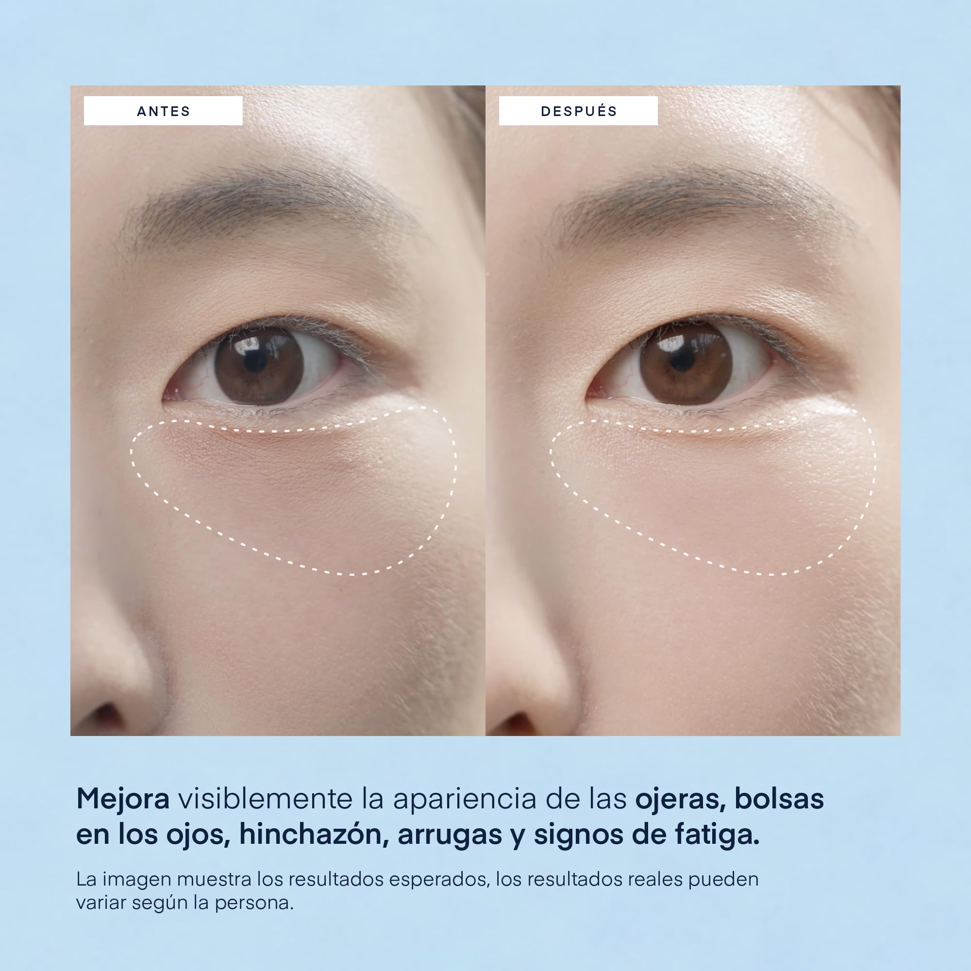 Parche Ojos para Bolsas y Ojeras Coreano: Antiarrugas y Contorno de Ojos con Cafeína Niacinamida y Ácido Hialurónico, Vegano, Testado en Piel Sensible, 30 Pares - Korean Skincare Under Eye Patches