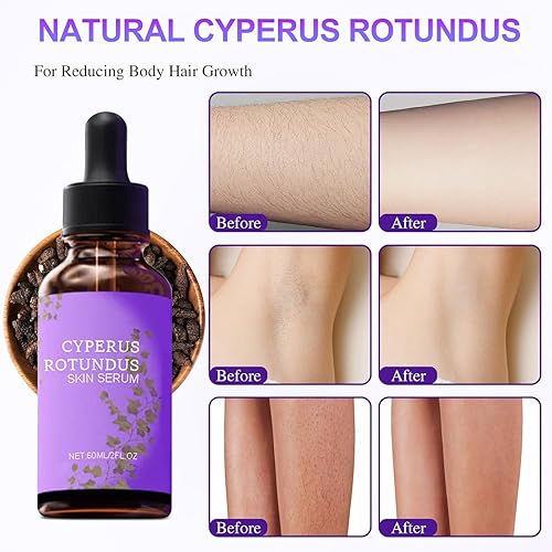 Miniatura 6 de Cyperus Rotundus Oil, Cyperus Rotundus Skin Serum, Natural Organic Moisturizing Soothing Body Oil, Reducing Body Hair