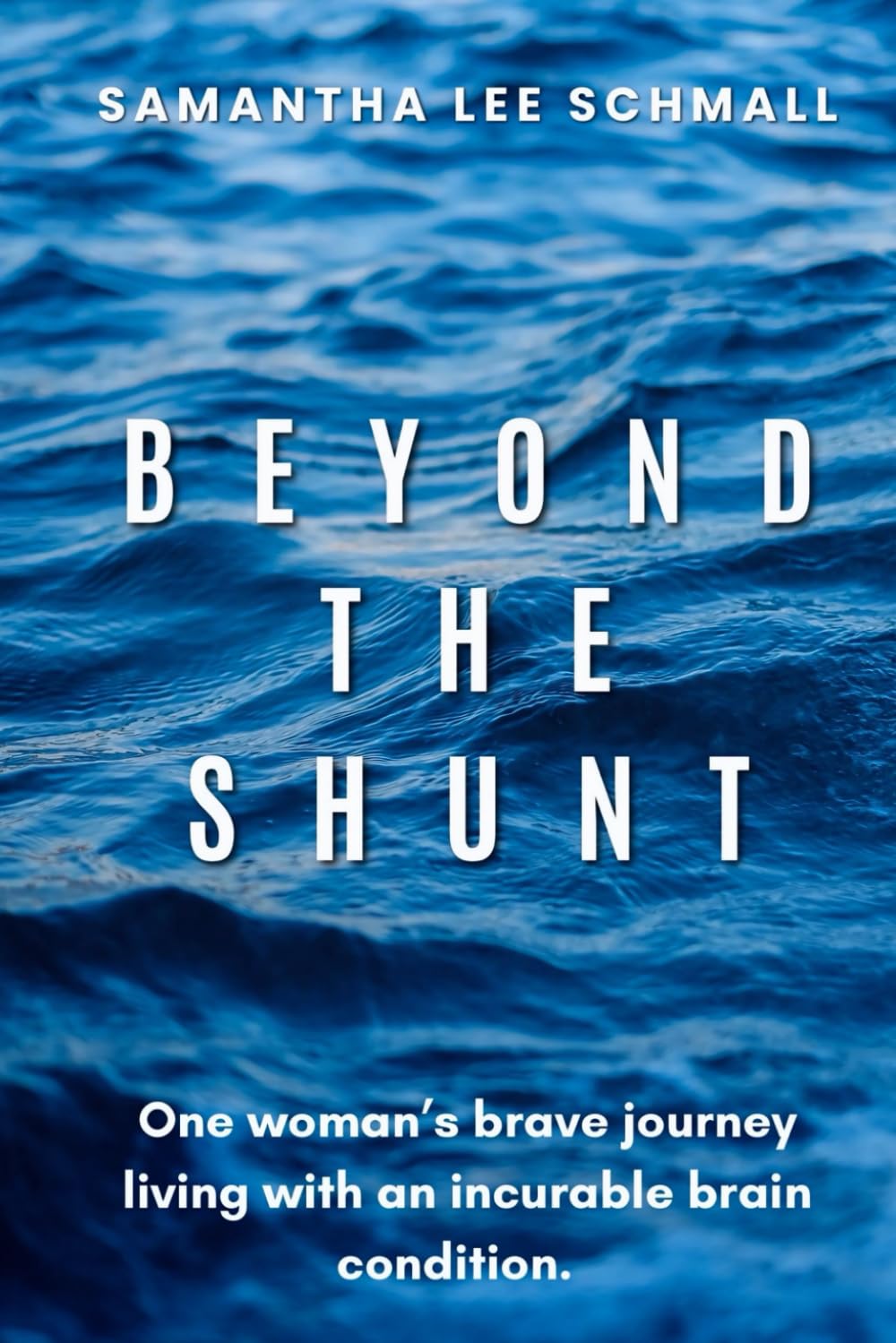 Beyond the Shunt