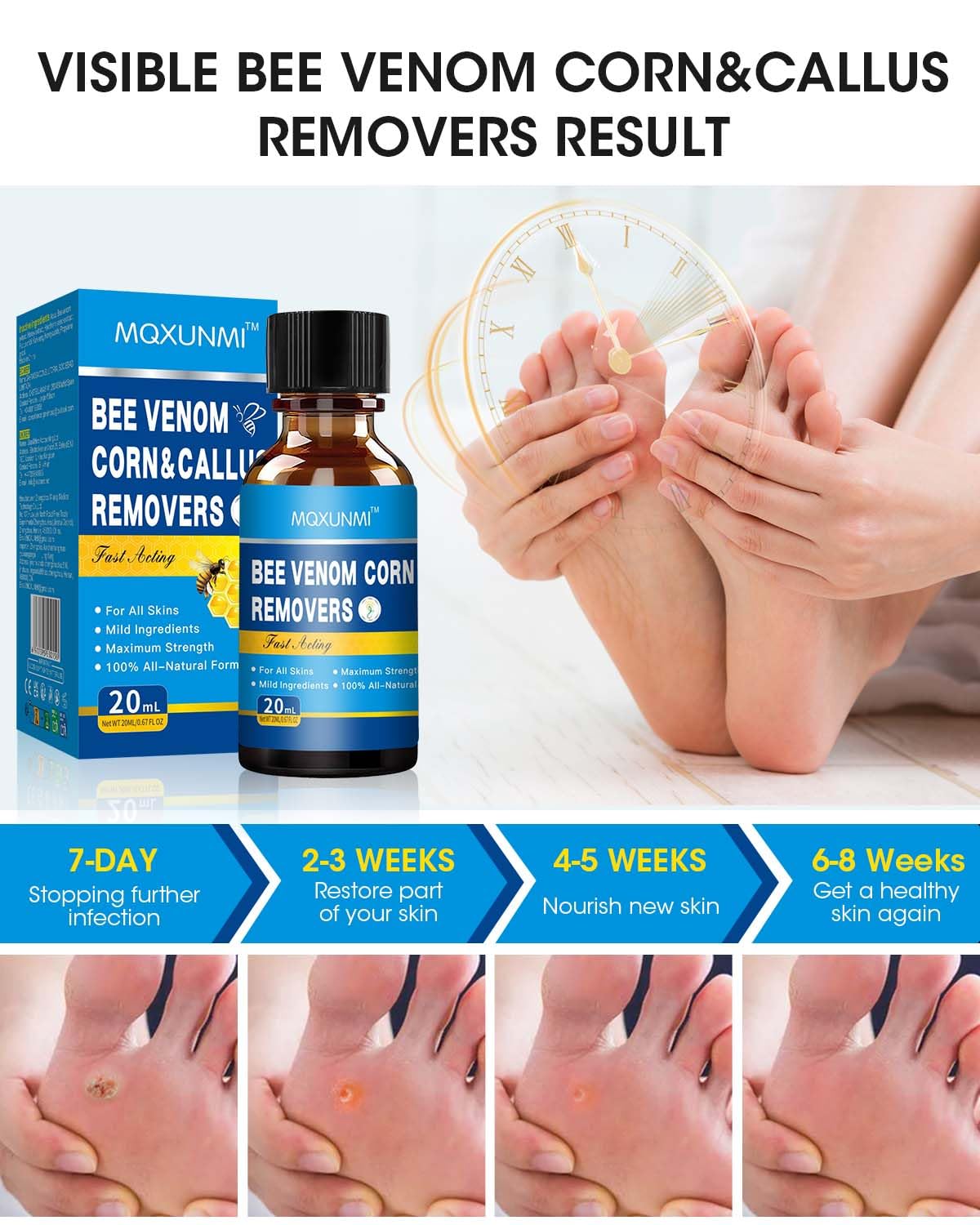 Removedor de Maíz con Veneno de Abeja, 20 ml Máxima Potencia, Eliminador de Callos Líquido para Pies, Acción Rápida, para Adultos, Personas Mayores, Adolescentes, Corredores, Senderistas