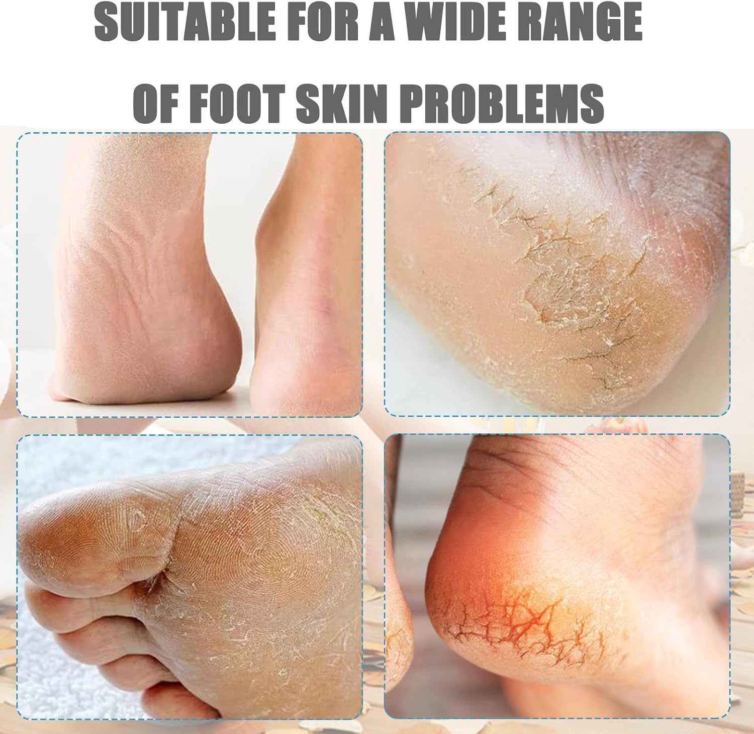 Foot Scrubber Brush for Shower, 4-in-1 Foot File Callus Remover with Foot Scrubber, Pumice Stone, Foot Rasp and Sand Paper,Effectively Removes Dead Skin from Feet,Multi Purpose for Home Foot Care