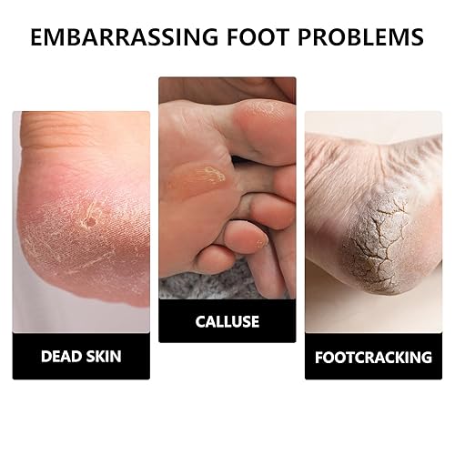 Miniatura 6 de C12rtive Brocas de disco de lijado para uñas, broca de carburo de diamante, brocas profesionales de manicura y pedicura para dar forma a las uñas,