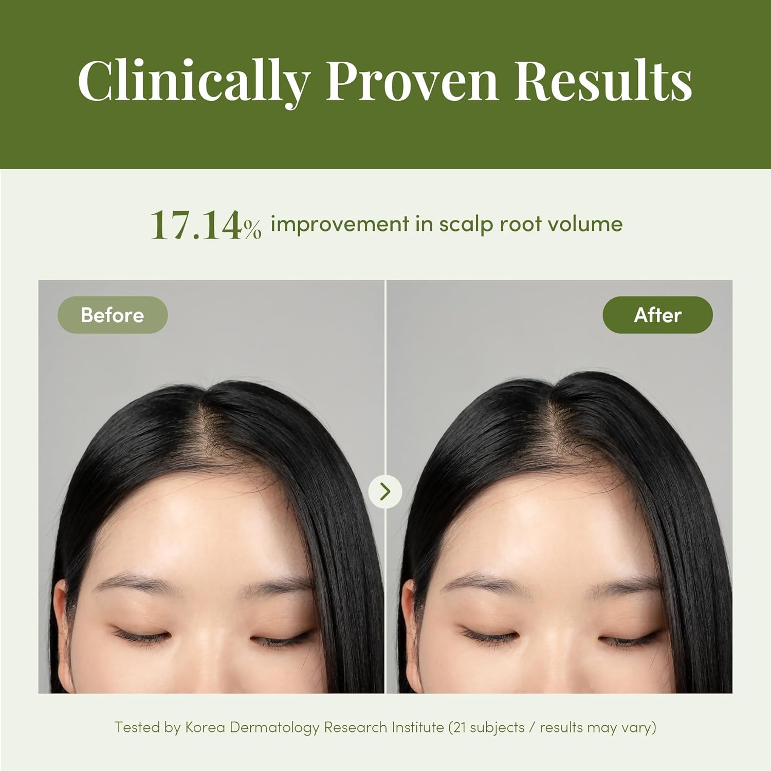 CURLYSHYLL Revitalizing Ampoule | Scalp Serum for Thinning Hair & Sensitive Scalp | Lightweight Daily Use | 50ml