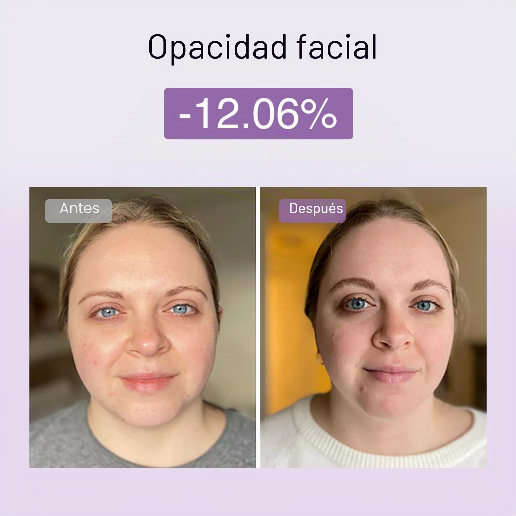 DermRays Dispositivo de belleza multifuncional M1,4 en 1, dispositivo facial de microcorriente para uso doméstico, dispositivo antienvejecimiento, para reafirmar la cara, arrugas, levantamiento
