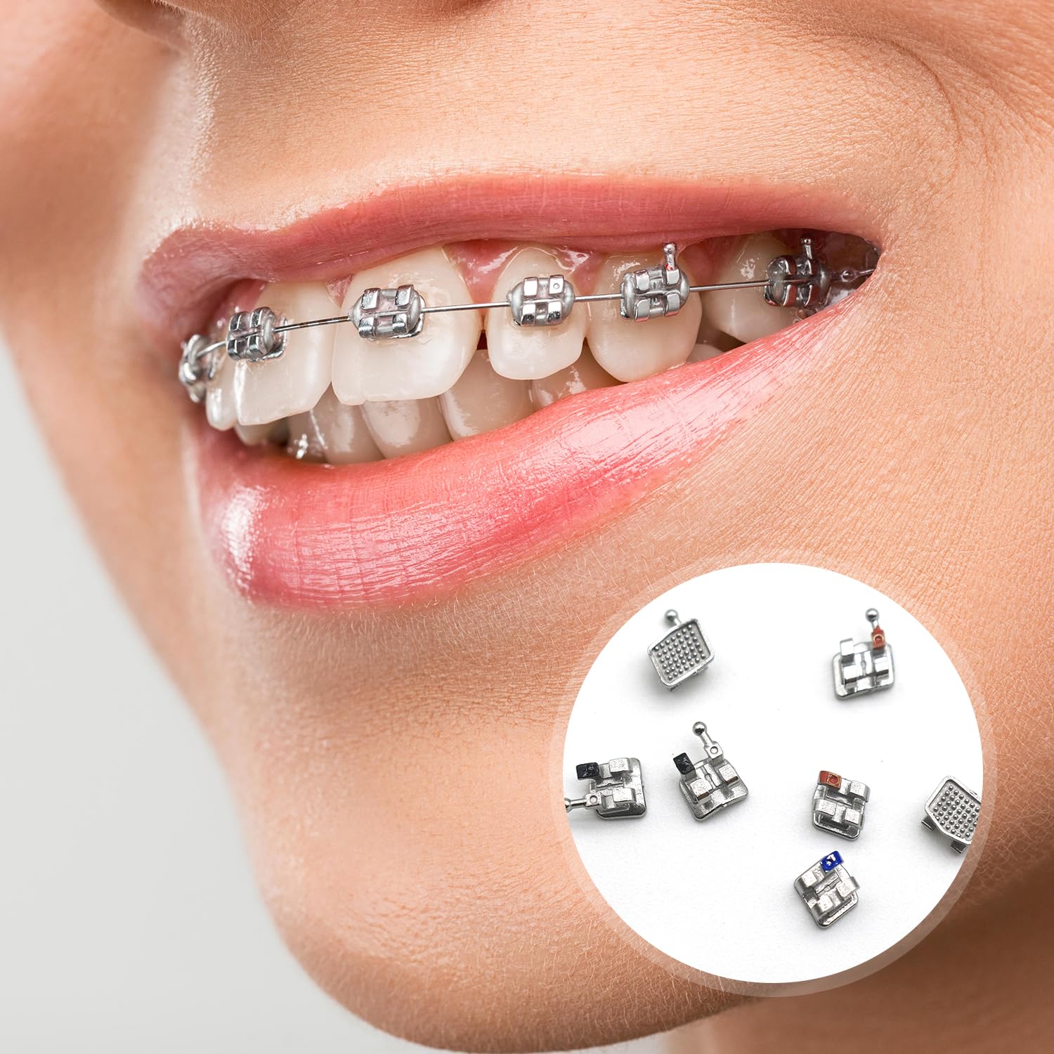 300pcs/Pack 022 Slot Bondable with Hook on 345 Teeth Model Mini Roth Brackets Roth,15 pieces per pack 20 pieces per pack.