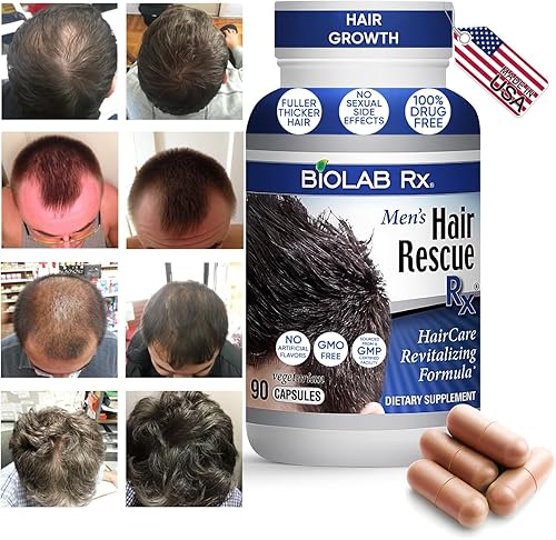 Miniatura 2 de Hair Rescue Rx - Vitaminas para el crecimiento del cabello con biotina, ortiga, para pérdida y adelgazamiento del cabello, apoya el crecimiento del