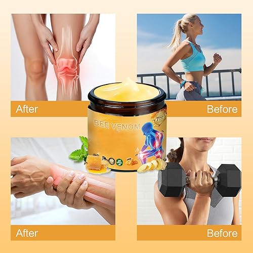 Miniatura 4 de Bee Venom Crema para articulaciones, crema de veneno de abeja para espalda, rodilla, cintura, manos traseras, pies y piernas masaje cuidado (1)