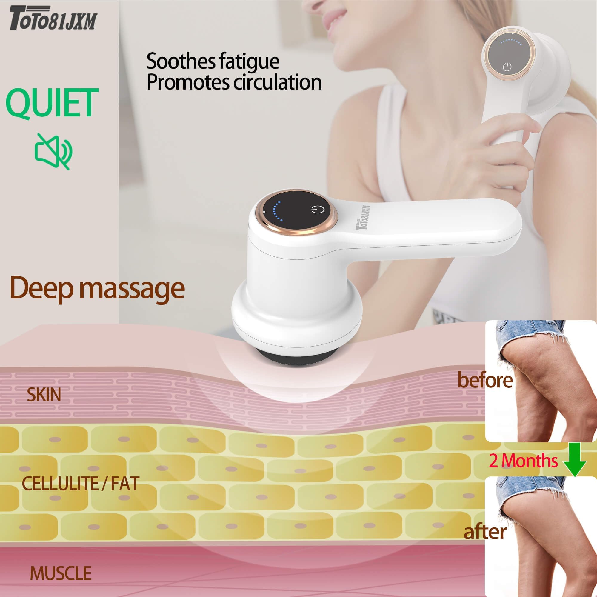 Amazon.com: TOTO81JXM Electric Cellulite Massager – Body Sculpting