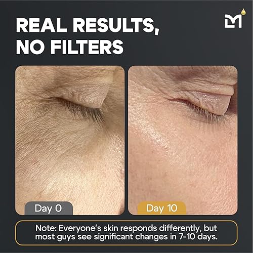 Miniatura 6 de Titan Oscar - Kit de cuidado de la piel antienvejecimiento para hombre, lavado, suero facial, crema para ojos, humectante facial para hombres, juego