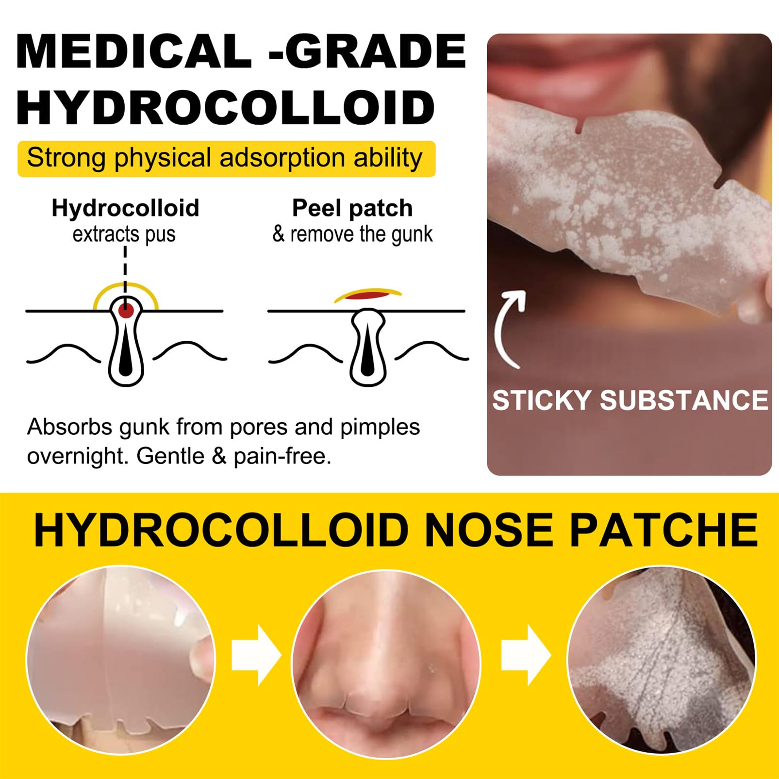 12Pcs Hydrocolloid Nose Strips,Blackhead Remover Strips,Nose Pore Strips for Unclog and Shrink Pores,Absorbs Oil,Removal Acne,Pimple,Zits,Spot,Targets Pores & Pimples - Image 3