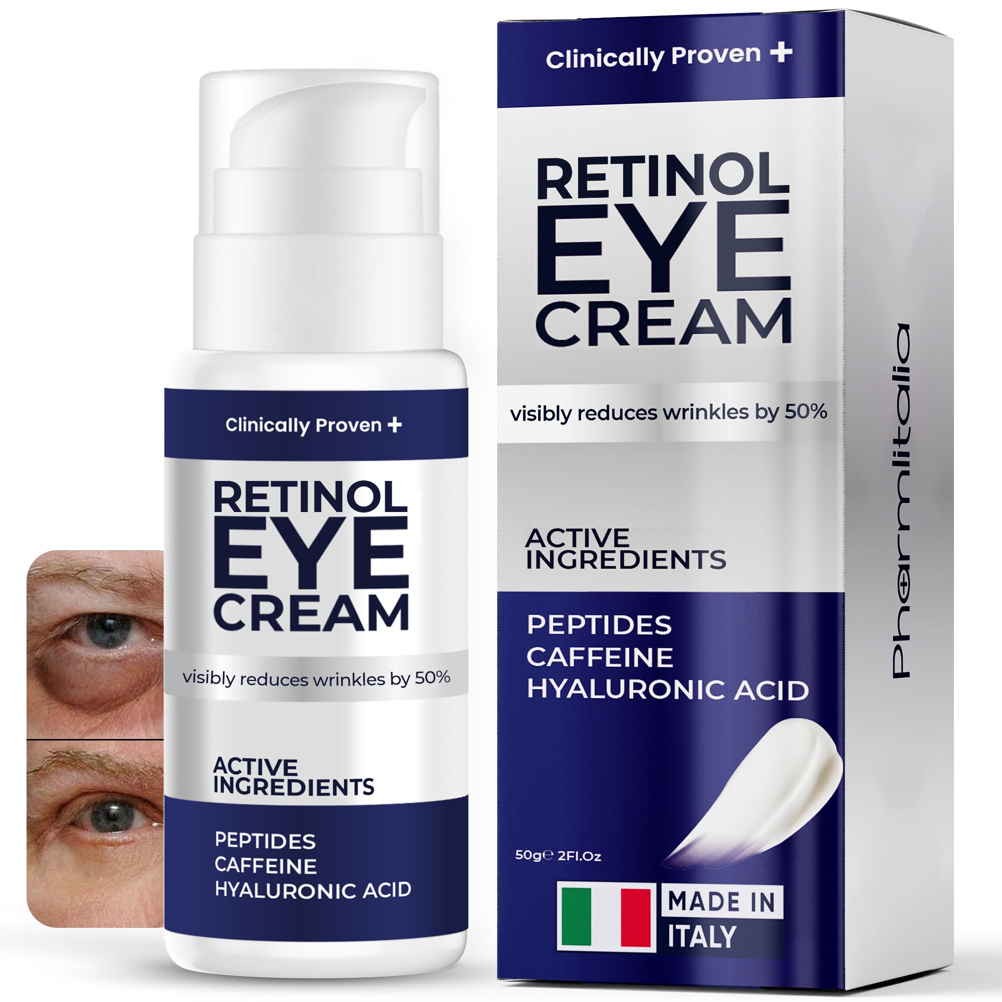 Under Eye Cream for Puffiness and Bags Under Eyes, Eye Bags Treatment for Men & Women - Anti Wrinkle Cream for Dark Circles, Baggy Eyes Treatment for Women with Retinol, Hyaluronic Acid & Caffeine