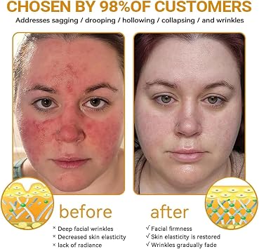 Bee Venom Skin Restoration Cream, Professional Bee V-enom Skin Treatment Cream,B ee Venom Comprehensive Creams, Repair, Moisturize and Lift 3 in 1, for All S kin Types (2 Pcs)