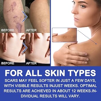 New Transparent Silicone Scar Sheets(1.6 x 120Inch - 3M),Away Scar Tape,Scar Strips, Reusable, Professional Scar Removal Sheets for C-Section, Surgery, Burn, Keloid, Acne et, Scar Patch.