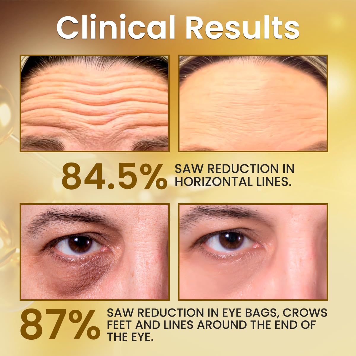 Gold Serum with 24K Gold and retinol 1%,anti wrinkle and Anti-Aging Essence,24K Anti Aging serum with niacinamide,Vitamin C&E Skin Care Glow Radiiance booster Serum 30ML/1.01 Oz - Image 2