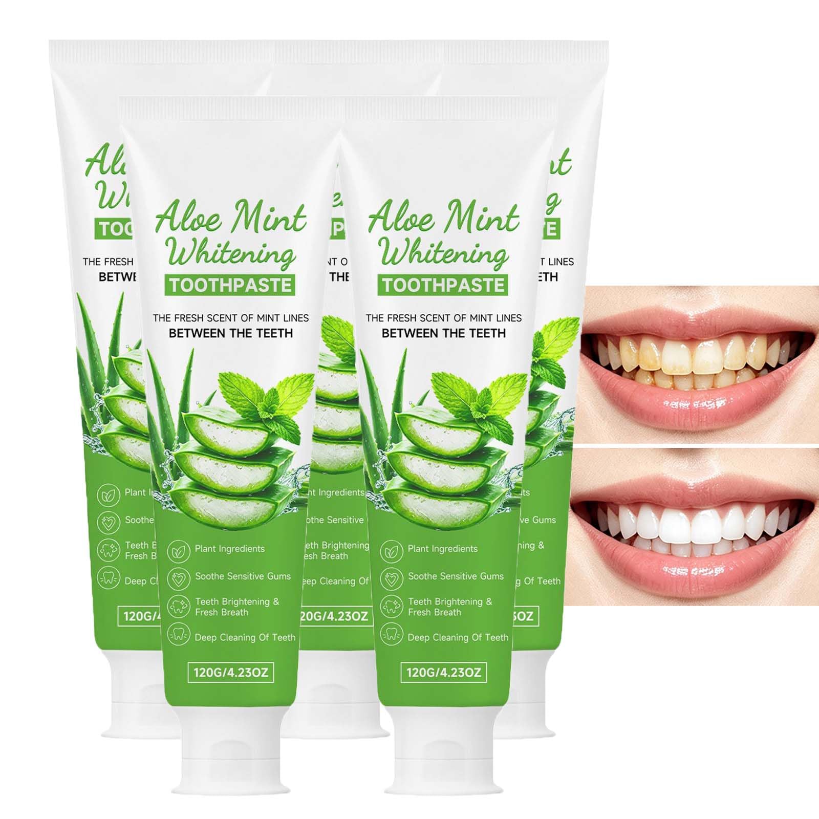 Dentifrice émail nettoyant blanchissant doux, dentifrice pour dents sensibles et soins des gencives, dentifrice rafraîchissant à l'aloe vera et à la menthe poivrée haleine fraîche (5pcs)