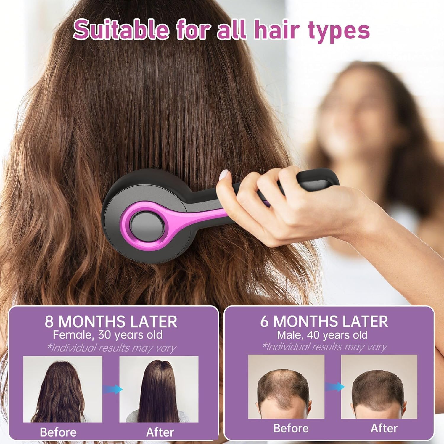 Masajeador de cabeza,2 en 1 eléctrico cepillo masajeador cuero cabelludo,masajeador cuero cabelludo,scalp massager, 3 modos para masaje y cuidado del (gris)