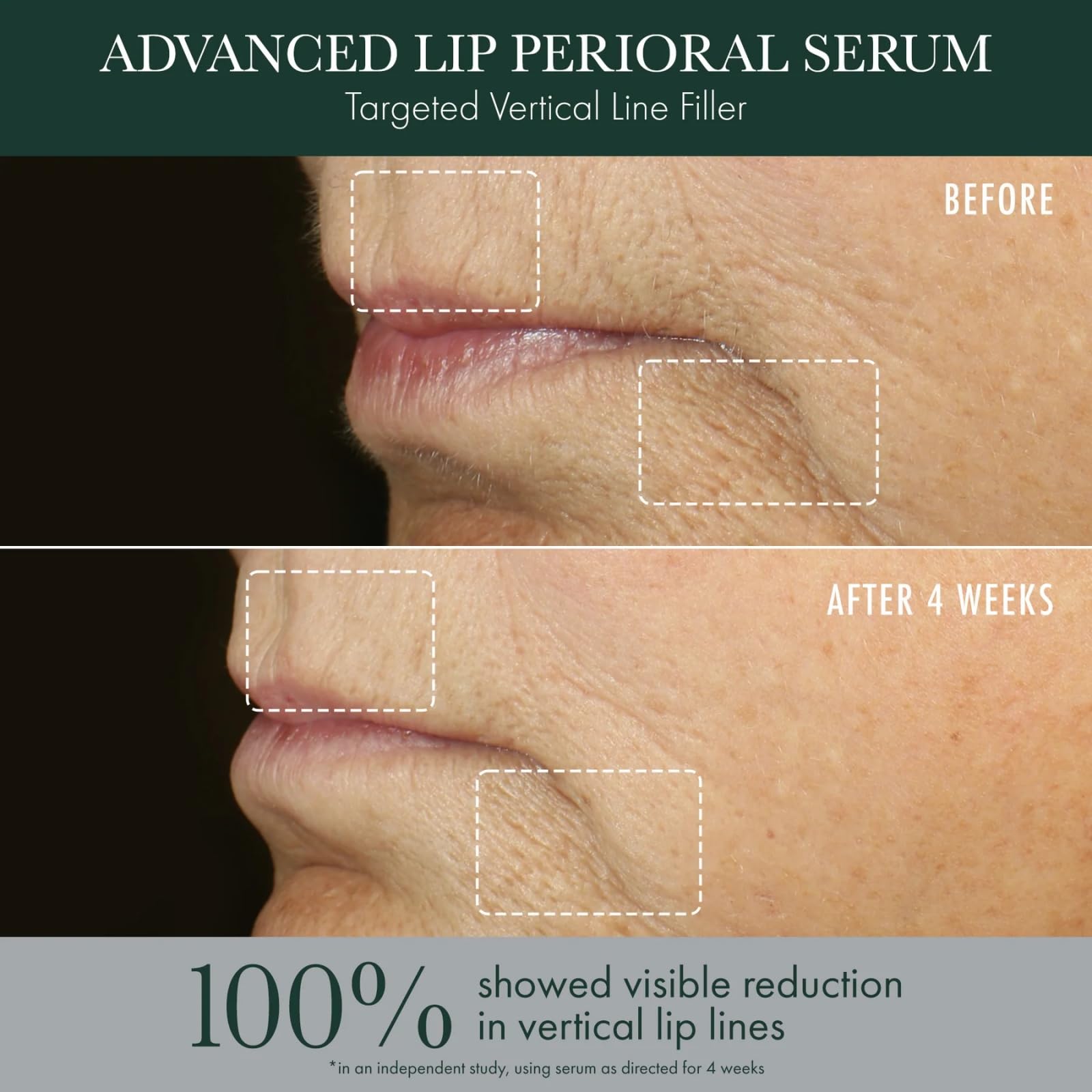 RéVive Advanced Perioral Lip Serum - Anti Aging Perioral Lip Treatment to Reduce Lip Area Lines & Wrinkles -Helps Restore Lip Contour & Visible Fullness(0.5 fl oz)