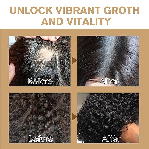 Miniatura 5 de Dr. Sebi - Acondicionador de aceite de batana sin enjuague para el crecimiento del cabello, aceite de batana natural con spray de menta y romero por