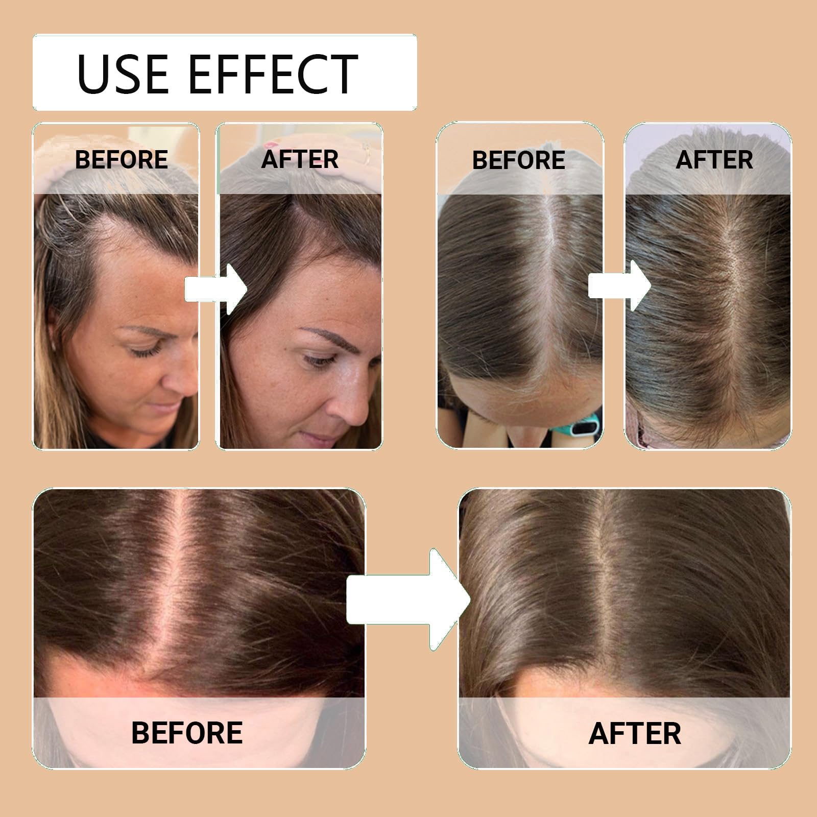 Volumizing Hair Care Ätherisches Öl Spray für trockenes Haar (3PCS)