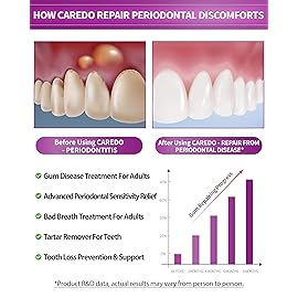 CAREDO Gum Toothpaste for Periodontitis, Gum Repair for Receding Gums, Gum Disease & Gingivitis Treatment, Periodontal Disease Treatment for Gum Health, Gum Disease Repair Bad Breath Toothpaste 2 Pack