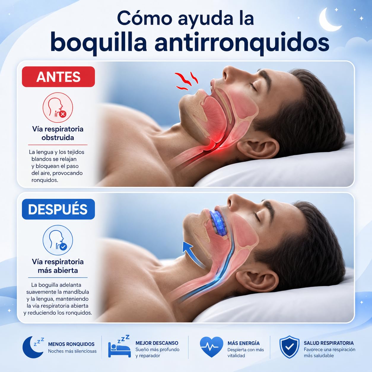 3 pcs Férula Antirronquidos Ajustable para Dormir, Dispositivos Anti Ronquidos, Dispositivo de Avance Mandibular Termomoldeable, Antironquidos Para Mayor Comodidad Y Fácil Respiración